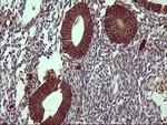 EPCAM Antibody in Immunohistochemistry (Paraffin) (IHC (P))