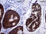 EPCAM Antibody in Immunohistochemistry (Paraffin) (IHC (P))