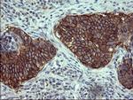 EPCAM Antibody in Immunohistochemistry (Paraffin) (IHC (P))