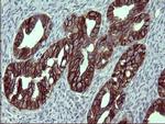 EPCAM Antibody in Immunohistochemistry (Paraffin) (IHC (P))