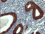 EPCAM Antibody in Immunohistochemistry (Paraffin) (IHC (P))