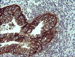 EPCAM Antibody in Immunohistochemistry (Paraffin) (IHC (P))