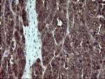 EPCAM Antibody in Immunohistochemistry (Paraffin) (IHC (P))