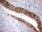 EPCAM Antibody in Immunohistochemistry (Paraffin) (IHC (P))