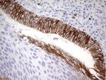 EPCAM Antibody in Immunohistochemistry (Paraffin) (IHC (P))