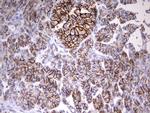 EPCAM Antibody in Immunohistochemistry (Paraffin) (IHC (P))