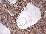EPCAM Antibody in Immunohistochemistry (Paraffin) (IHC (P))