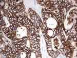 EPCAM Antibody in Immunohistochemistry (Paraffin) (IHC (P))