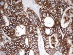 EPCAM Antibody in Immunohistochemistry (Paraffin) (IHC (P))