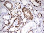 EPCAM Antibody in Immunohistochemistry (Paraffin) (IHC (P))