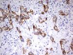 EPCAM Antibody in Immunohistochemistry (Paraffin) (IHC (P))