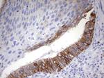 EPCAM Antibody in Immunohistochemistry (Paraffin) (IHC (P))