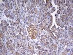 EPCAM Antibody in Immunohistochemistry (Paraffin) (IHC (P))