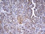 EPCAM Antibody in Immunohistochemistry (Paraffin) (IHC (P))