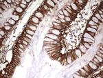 EPCAM Antibody in Immunohistochemistry (Paraffin) (IHC (P))
