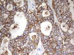 EPCAM Antibody in Immunohistochemistry (Paraffin) (IHC (P))