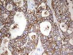 EPCAM Antibody in Immunohistochemistry (Paraffin) (IHC (P))
