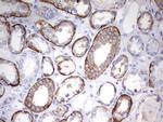 EPCAM Antibody in Immunohistochemistry (Paraffin) (IHC (P))