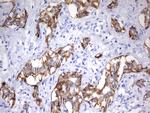 EPCAM Antibody in Immunohistochemistry (Paraffin) (IHC (P))