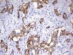 EPCAM Antibody in Immunohistochemistry (Paraffin) (IHC (P))
