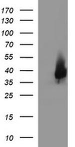 EPCAM Antibody in Western Blot (WB)