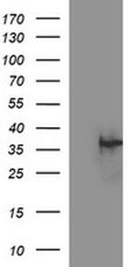 EPCAM Antibody in Western Blot (WB)