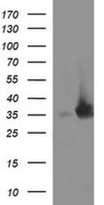 EPCAM Antibody in Western Blot (WB)