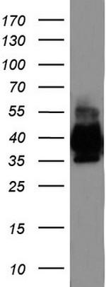 EPCAM Antibody in Western Blot (WB)