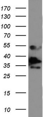 EPCAM Antibody in Western Blot (WB)