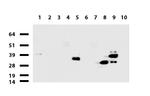 EPCAM Antibody in Western Blot (WB)