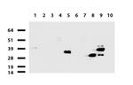 EPCAM Antibody in Western Blot (WB)