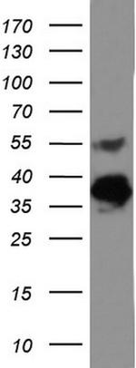 EPCAM Antibody in Western Blot (WB)