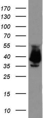 EPCAM Antibody in Western Blot (WB)