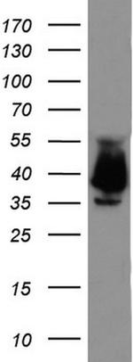 EPCAM Antibody in Western Blot (WB)