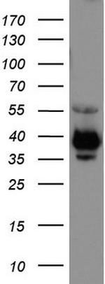 EPCAM Antibody in Western Blot (WB)