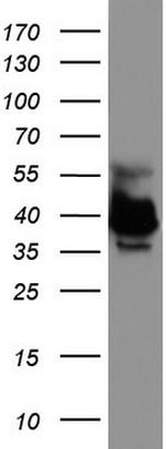 EPCAM Antibody in Western Blot (WB)