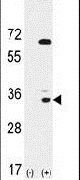 EphA10 Antibody in Western Blot (WB)