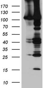 EPHA4 Antibody in Western Blot (WB)