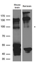 EPHA4 Antibody in Western Blot (WB)