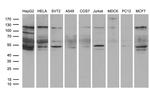 EPHA6 Antibody in Western Blot (WB)