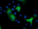 EPHX2 Antibody in Immunocytochemistry (ICC/IF)