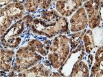 EPHX2 Antibody in Immunohistochemistry (Paraffin) (IHC (P))