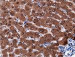 EPHX2 Antibody in Immunohistochemistry (Paraffin) (IHC (P))