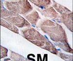 EPM2A Antibody in Immunohistochemistry (IHC)