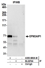 EPM2AIP1 Antibody in Western Blot (WB)