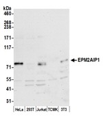 EPM2AIP1 Polyclonal Antibody