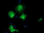 EPM2AIP1 Antibody in Immunocytochemistry (ICC/IF)