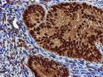 EPM2AIP1 Antibody in Immunohistochemistry (Paraffin) (IHC (P))