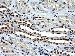 EPM2AIP1 Antibody in Immunohistochemistry (Paraffin) (IHC (P))