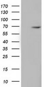 EPM2AIP1 Antibody in Western Blot (WB)